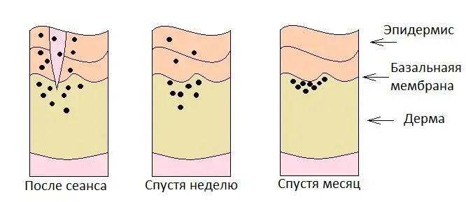 15 Типы татумашинок Типы татумашинок можно разделить на три основные - фото 13