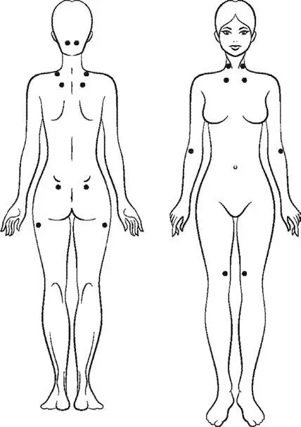 Рис 11 Болезненные точки при фибромиалгии На задней поверхности тела - фото 1