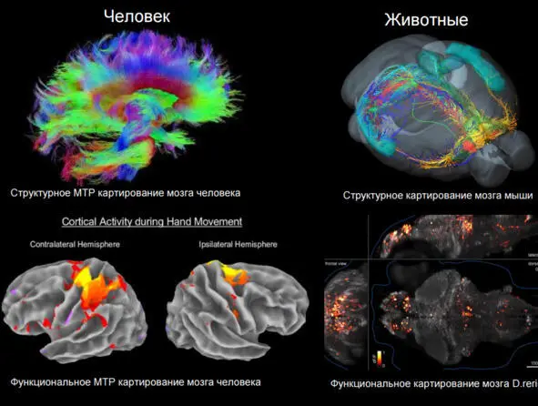 Рис 3 Структурное и функциональное картирование мозга Анохин 2016 В - фото 3