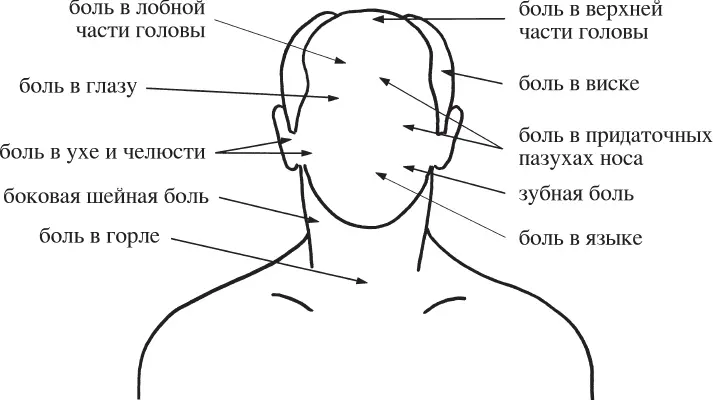 Боль в области головы и шеи Пусковые точки вызывают самые разнообразные - фото 13
