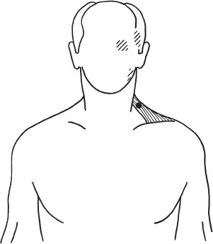 Рис 47Пусковая точка номер 1 в трапециевидной мышце и область отраженной - фото 21