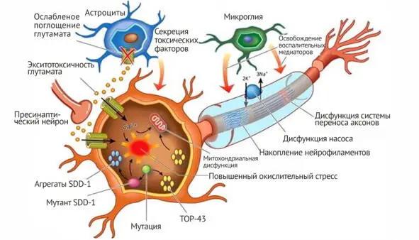 Рис 2 Схема локальных молекулярных повреждений в двигательном нейроне при - фото 5