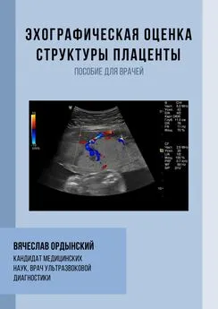 Вячеслав Ордынский - Эхографическая оценка структуры плаценты