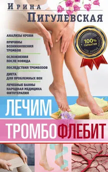 Ирина Пигулевская - Лечим тромбофлебит. 100% гарантия улучшения состояния ваших вен