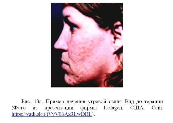 Основные свойства фибробластов сохраняются при культивировании их вне - фото 19