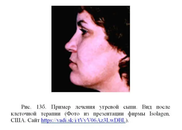 Основные свойства фибробластов сохраняются при культивировании их вне - фото 20