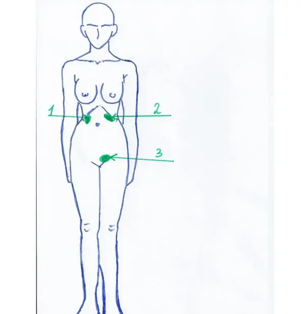Рис10 Локализация боли при холецистите 1 панкреатите 2 внематочной - фото 11