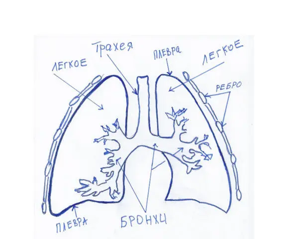 Рис5 Лёгкие бронхи плевра 7Остеохондроз Боль в грудной клетке - фото 6