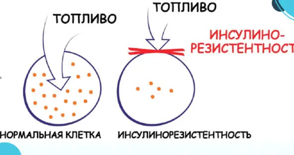 На этапе инсулинорезистентности мы видим нормальный и даже пониженный уровень - фото 4