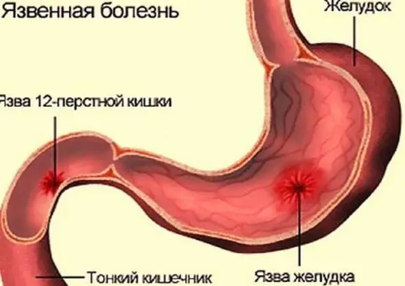 Имеются противопоказания Необходима консультация специалиста Как бы не - фото 1