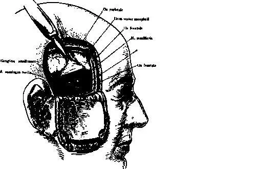 10 Как врачи понимают от чего у вас болит голова Типичная история болезни - фото 4