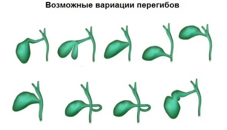 В ситуации когда есть перегиб но при этом нет жалоб по анализам и - фото 5