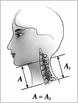 Рис 7 Нормальная статика шеи Правильный физиологический изгиб АА 1 - фото 12