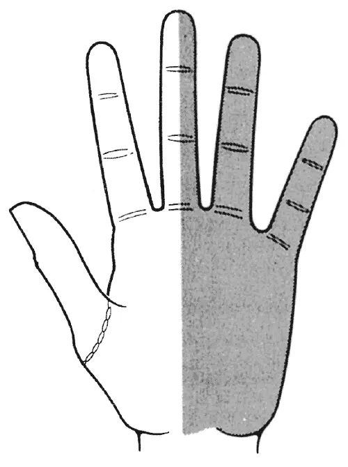 Радиальная сторона ладони Радиальная сторона ладони та где расположен большой - фото 13