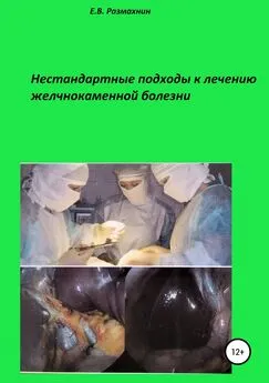 Евгений Размахнин - Нестандартные подходы к лечению желчнокаменной болезни