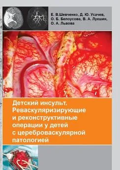 Коллектив авторов - Детский инсульт. Реваскуляризирующие и реконструктивные операции у детей с цереброваскулярной патологией