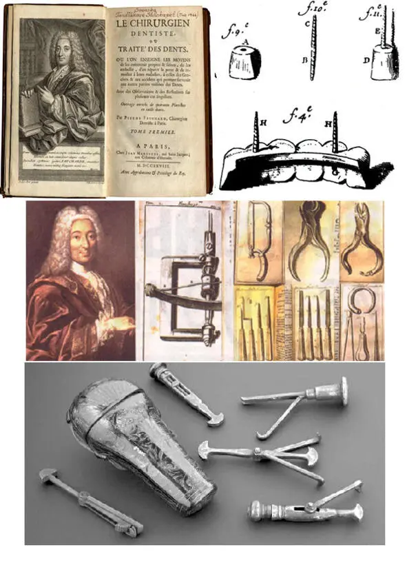 1778 год Джон Хантер издал Практический трактат о заболеваниях зубов в - фото 13