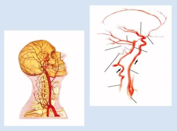 Дело в том что ткани центральной нервной системы в том числе её главная - фото 2