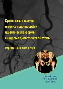 Сергей Терёхин - Критическая ишемия нижних конечностей и ишемические формы синдрома диабетической стопы