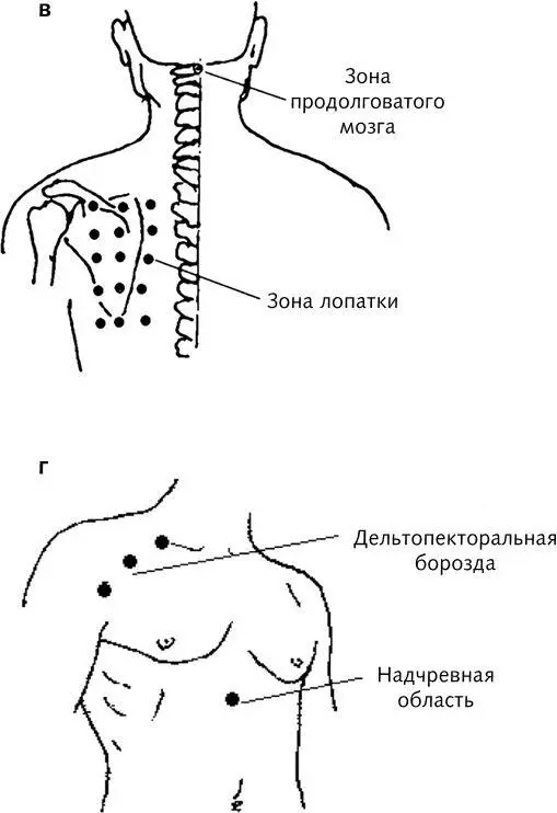 Рис 1 в г Массаж для укрепления сердечной мышцы Кардионевротические - фото 4