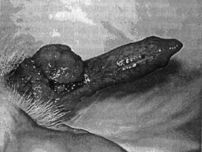 Рис 18 Обширные вегетации трансмиссивной венерической опухоли на луковице - фото 37