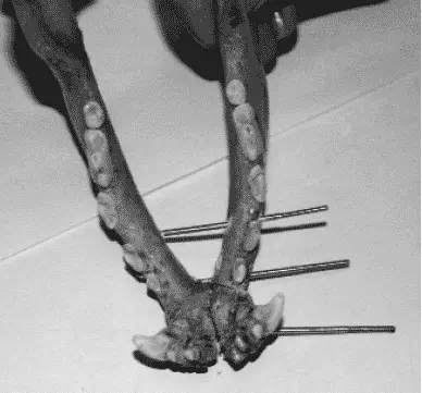 Рис 54 Трансмандибулярное введение стержней ВВ Хубирьянц 2003 предлагает - фото 65
