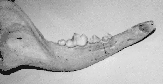 Рис 55 Фиксация перелома поликоном Через выполненные отверстия проводится - фото 66