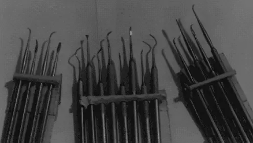 Рис 64 Различные наборы для снятия зубных отложений Недостаток этого метода - фото 75