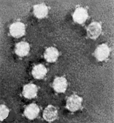 Электронная микрофотография фага Х174 без отростка с выступами головка 25 нм в - фото 252