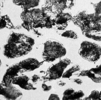 Рис 2и Типичные структуры железоуглеродистых сплавов Белый доэвтектический - фото 67