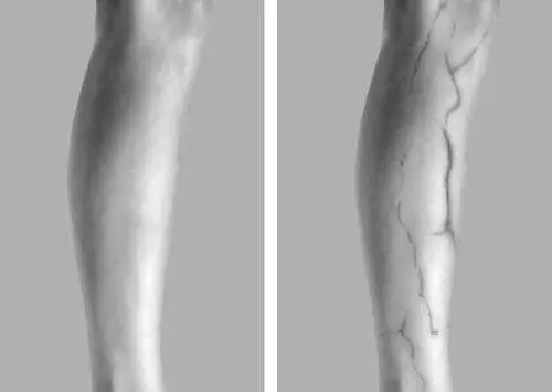Фотография ноги слева в видимом справа в инфракрасном излучении на - фото 440