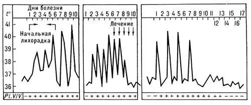 Рис 2 Температурная кривая при трёхдневной малярии а начальная лихорадка - фото 521