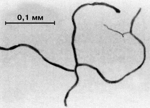 Микоплазмы Электронная микрофотография М mycoides выращена в жидкой - фото 46