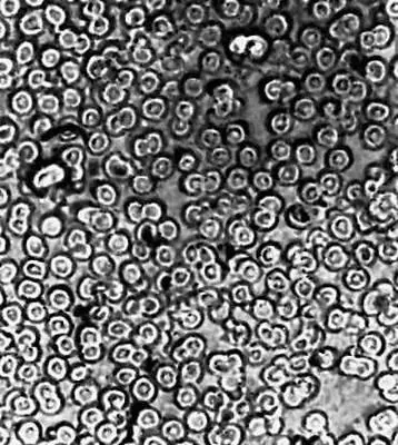Рис 5а Красные кровяные тельца полученные оптическим микроскопом Рис 8 - фото 52