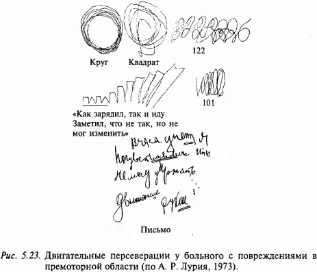 В тех случаях когда поражение располагается в нижних отделах премоторной зоны - фото 67