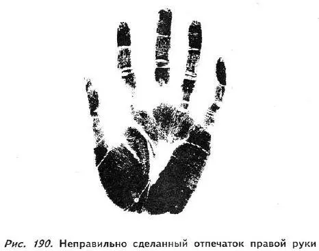 В подобных случаях я прошу человека слегка приподнять руки после чего - фото 184