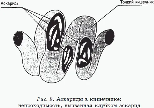 Последствия кишечной фазы развития аскарид особенно опасны для будущих матерей - фото 18