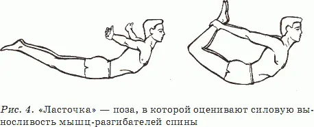 Нарушения осанки Отклонения от нормальной осанки называются нарушениями или - фото 4