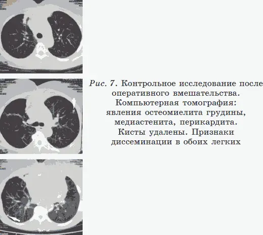 Проводим ВРД У пациентки тестируем геопатогенную нагрузку психические - фото 7