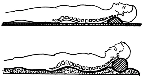 Рис 1 Положение позвонков на ровной и твердой постели вверху и на мягкой - фото 2