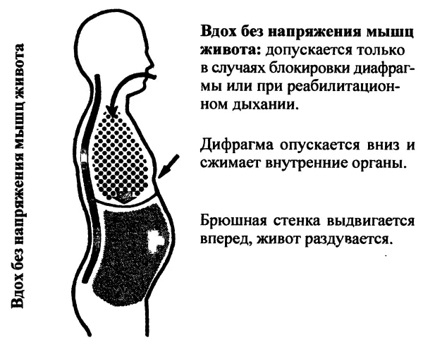 При таком дыхании возникает хроническая деформация брюшной стенки и живота - фото 9