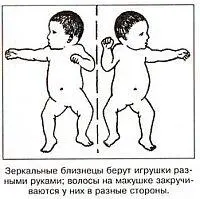 Зеркальные близнецы берут игрушки разными руками волосы на макушке - фото 39