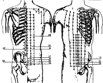 Рис 65Акупунктурные точки при импотенции Рис 66Акупунктурные точки при - фото 75