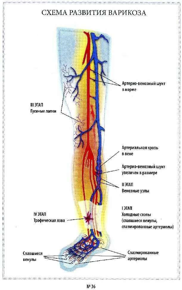 После курса лечения проведённого под тепловизионным контролем исчезли - фото 23