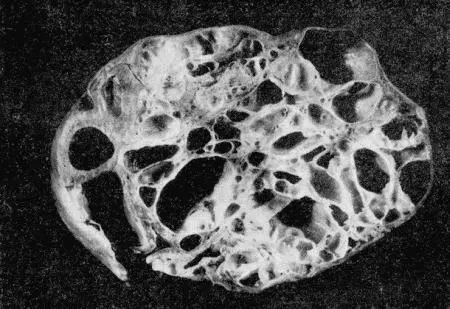 Рис 156 Саркома матки суки Опухоли обычно имеют вид единичных ограниченных - фото 159