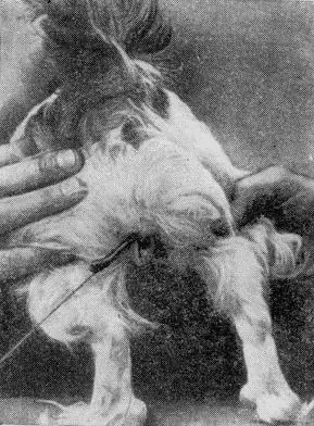 Рис 159 Опухоль преддверия влагалища в виде тонкого длинного тяжа Решающее - фото 162