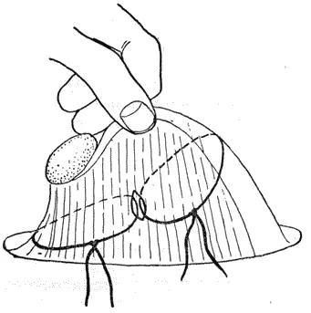 Рис 161 Удаление яичника у суки при помощи прошивных лигатур - фото 164