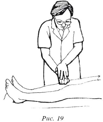 Ногу сгибают в коленном суставе Большой палец врача при этом помещается на - фото 156