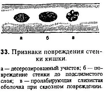 Увеличение объема инфильтрированных тканей также затрудняет ориентировку изза - фото 31