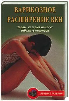 Вера Подколзина - Варикозное расширение вен. Травы, которые помогут избежать операции